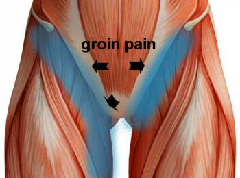 Showing the muscles of the groin